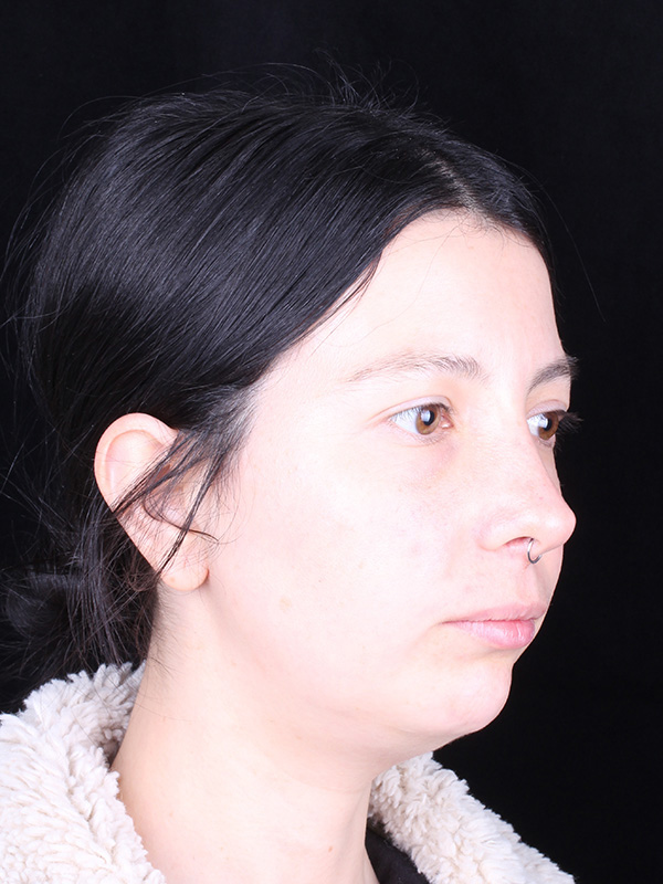 catalina-antes-lateral