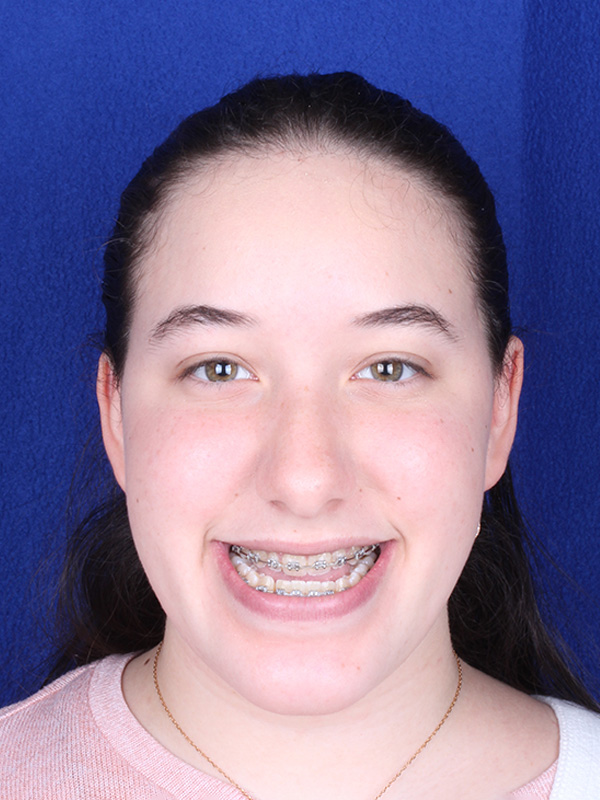 cristina-antes-frontal