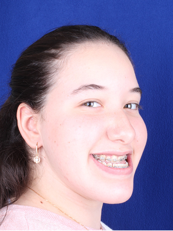 cristina-antes-lateral