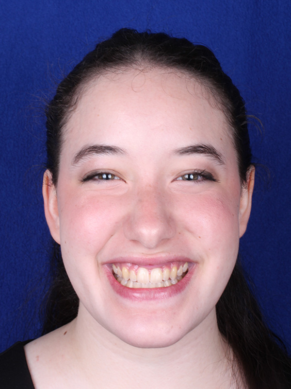 cristina-despues-frontal