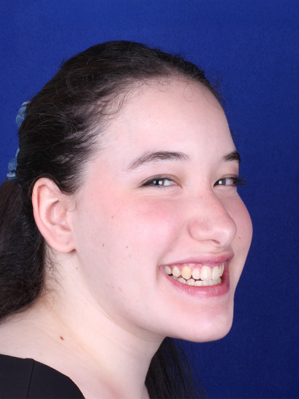 cristina-despues-lateral