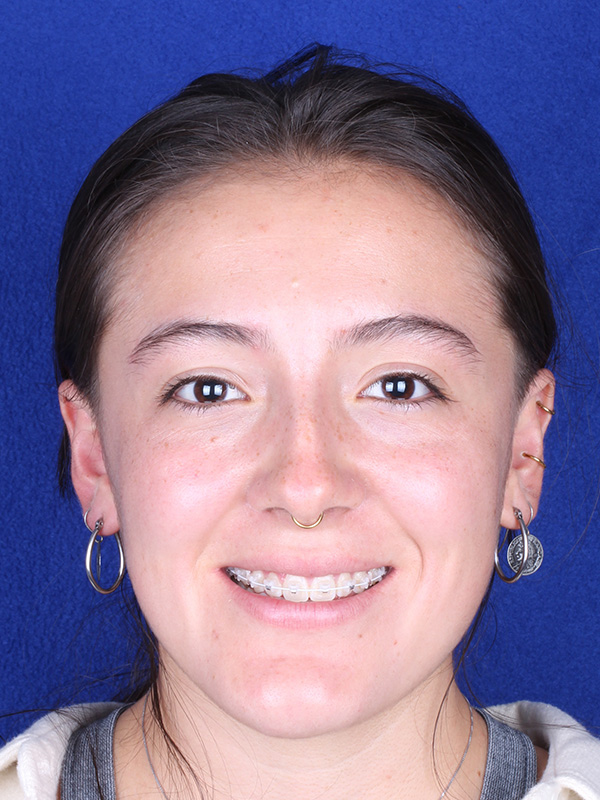 isabella-antes-frontal