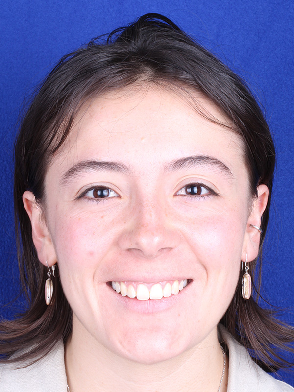 isabella-despues-frontal