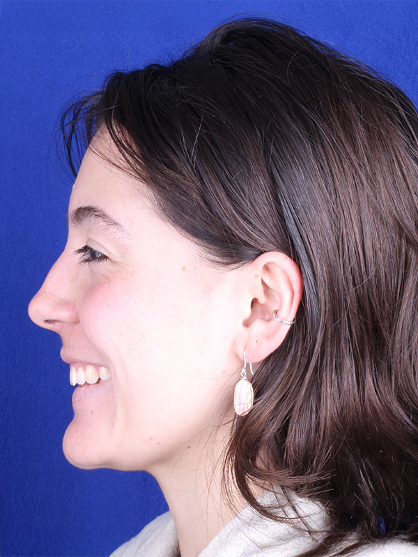 isabella-despues-lateral