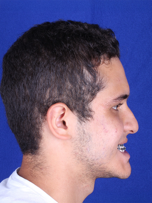 juan-antes-lateral