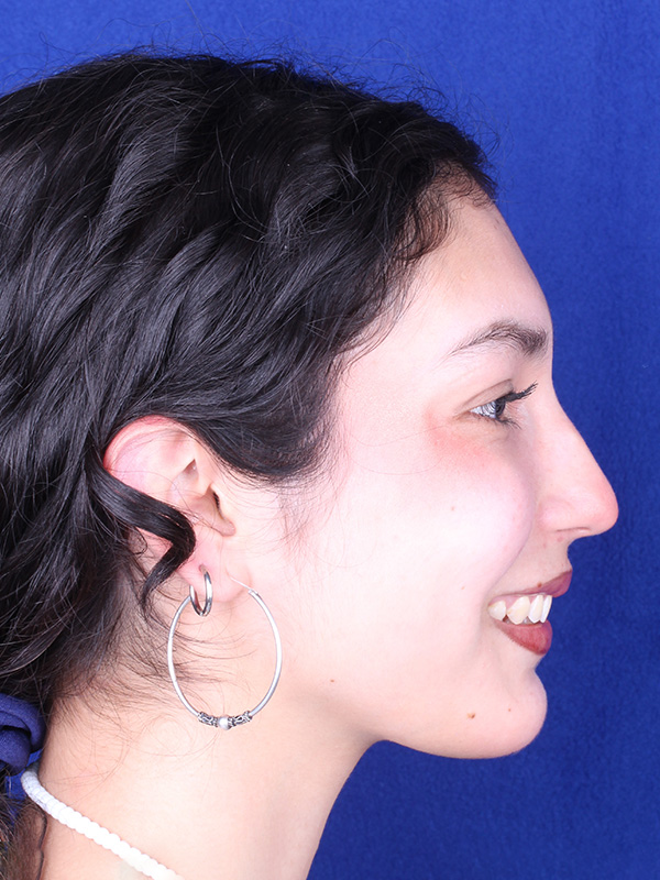 maria-despues-lateral